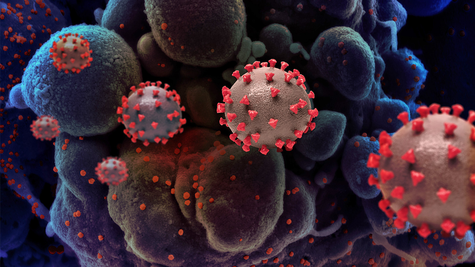 سازمان جهانی بهداشت: ویروس کرونا به عنوان عامل دائمی باقی خواهد ماند